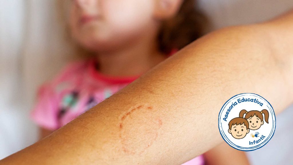 Consejos para padres cuando su hijo muerde